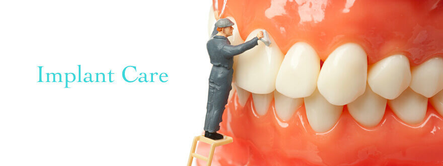 are dental implants hard to clean?
