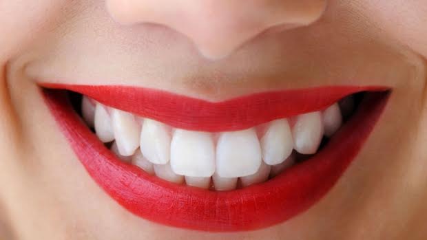 Perfect Smile
