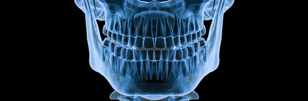 dental x rays how often