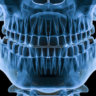 dental x rays how often