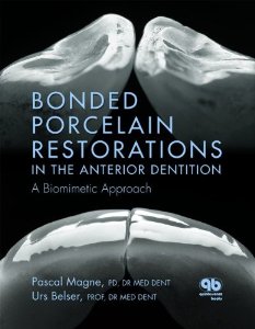 Bonded Porcelain Restorations In the Anterior Dentition - A Biomimetic Approach