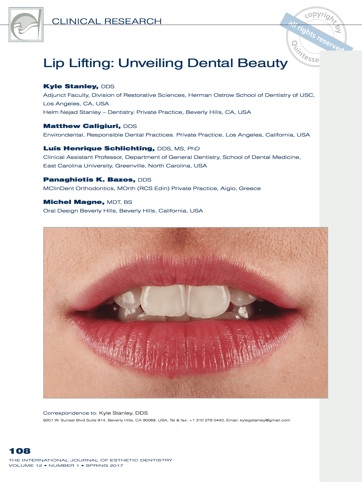 Dental Lip Lift SLIP Stanley Lip Incisal Planning