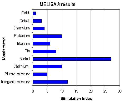 melisa titanium allergy test results