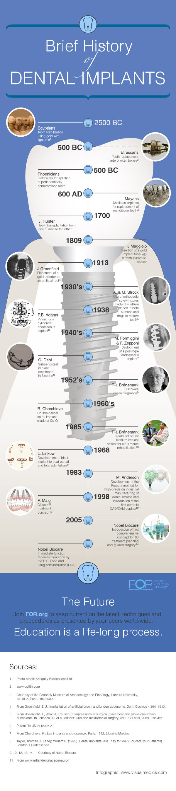 Dental implants history infographic