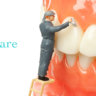 are dental implants hard to clean?