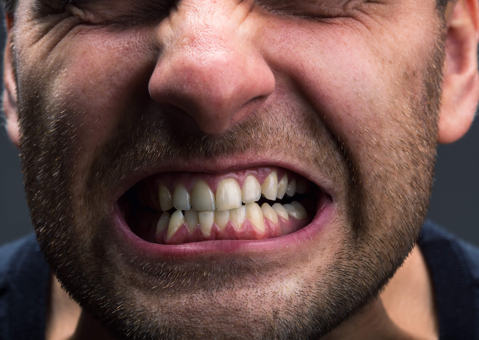 grinding and clenching teeth causes gum recession