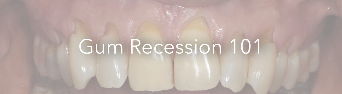 what causes gum recession graphic