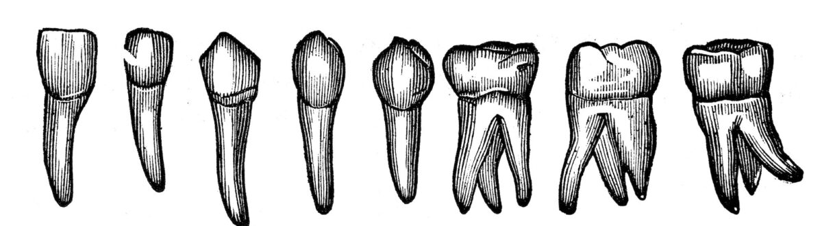 history of dental implants