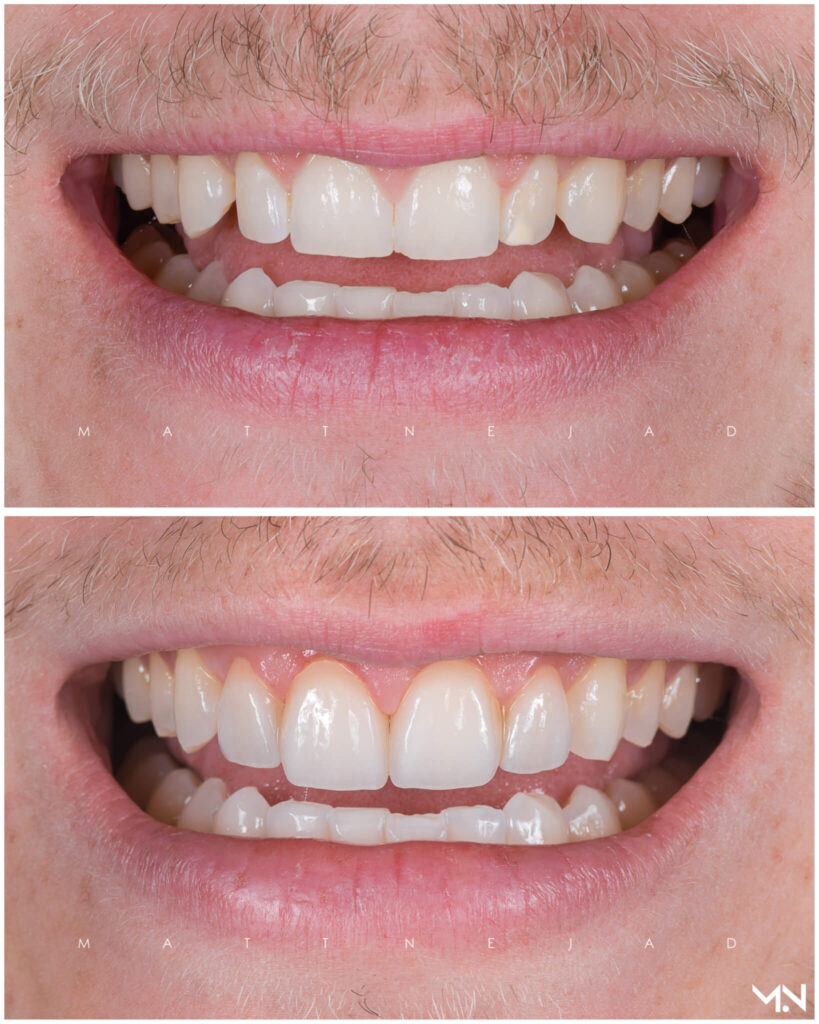 Cosmetic Dentistry Before and After Photos Helm Nejad Stanley