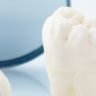 restorative dentistry