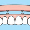teeth drawing