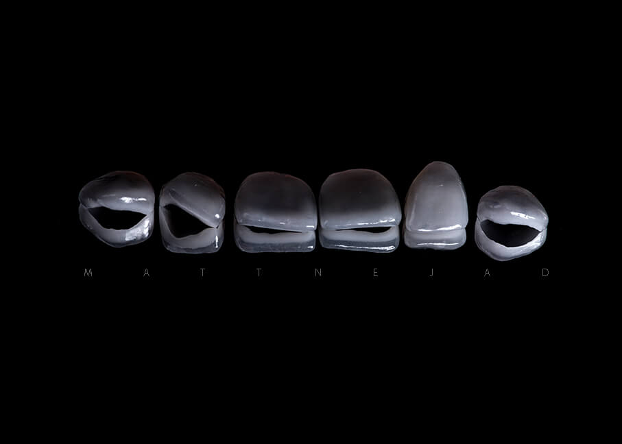 veneers on black background