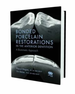 Bonded Porcelain Restorations in the Anterior Dentition: A Biomimetic Approach