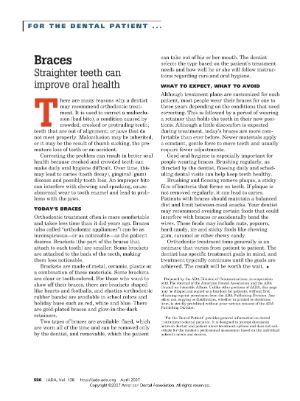 Braces - Straighter teeth can improve oral health - thumbnail