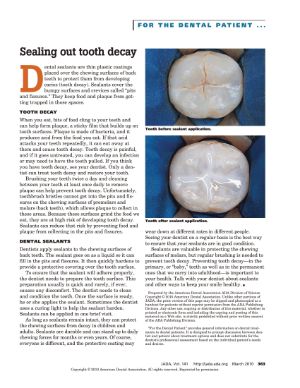 Dental Sealants - Sealing out tooth decay - thumbnail