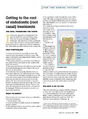 Root Canals - What exactly is a root canal? - thumbnail