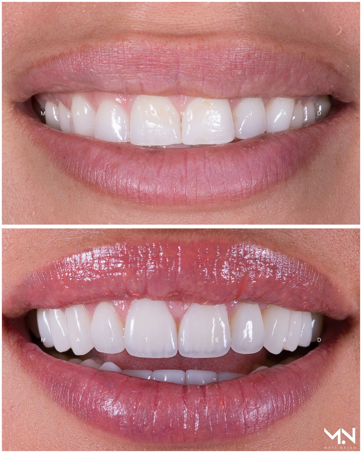 Cosmetic Dentistry Before And After Photos Helm Nejad Stanley